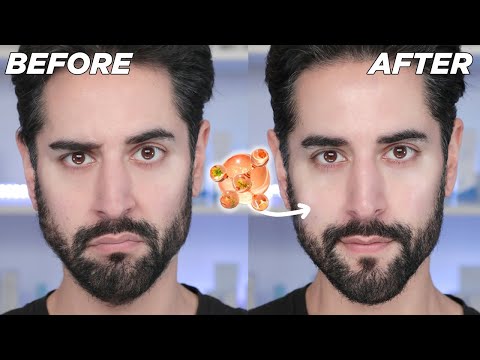 ad Your Most Hydrated Skin Ever? The New COSRX 5-PDRN Routine