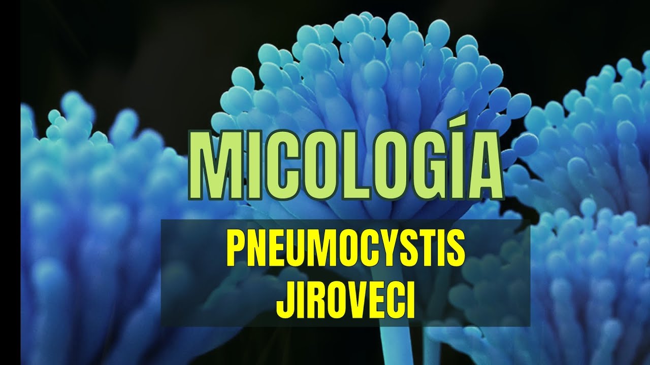 PNEUMOCYSTIS JIROVECI / CARINII | Tema 13 | Micología| Microbacter