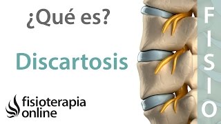 Discartrosis - ¿Qué es