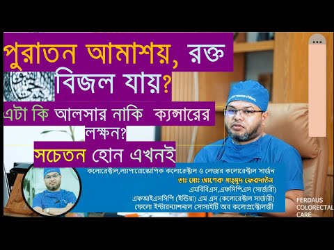 আলসারেটিভ কোলাইটিস কি, কারণ, লক্ষন ও প্রতিকার