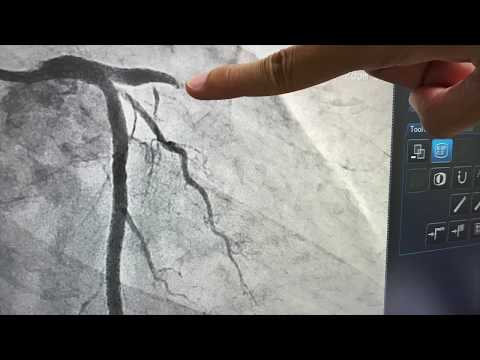 CathWorks - Overview