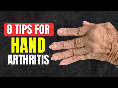 8 Tips to Reduce Hand Arthritis Pain (Physical Therapy Approved)