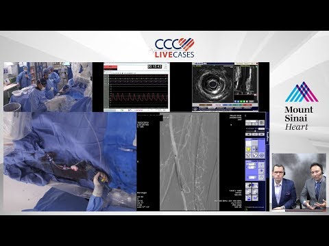 Left SFA CTO - Oct 2019