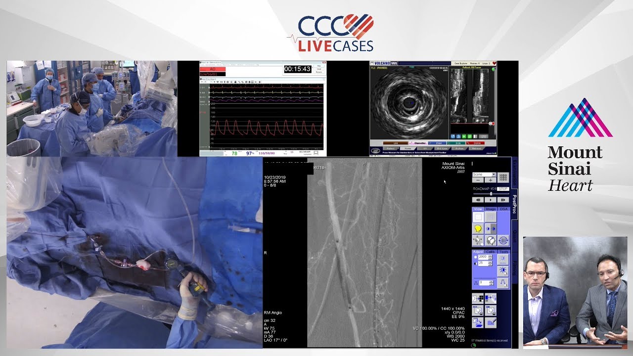 Left SFA CTO - Oct 2019
