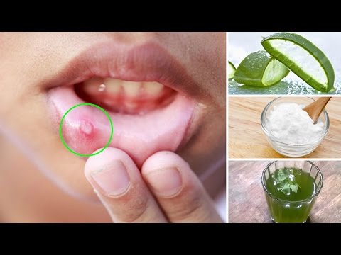 Ito ay mas mahusay mikoderil ekzoderil Lotseril Paa halamang-singaw at nail