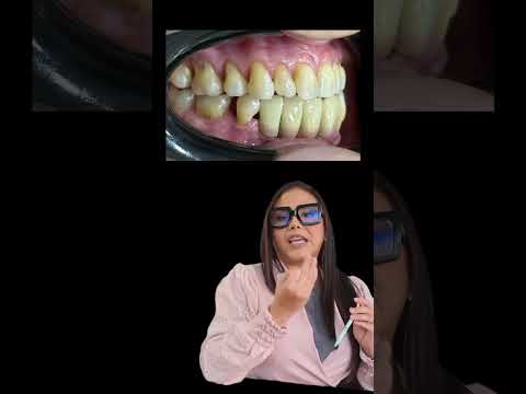 video FHPz16dRYM8