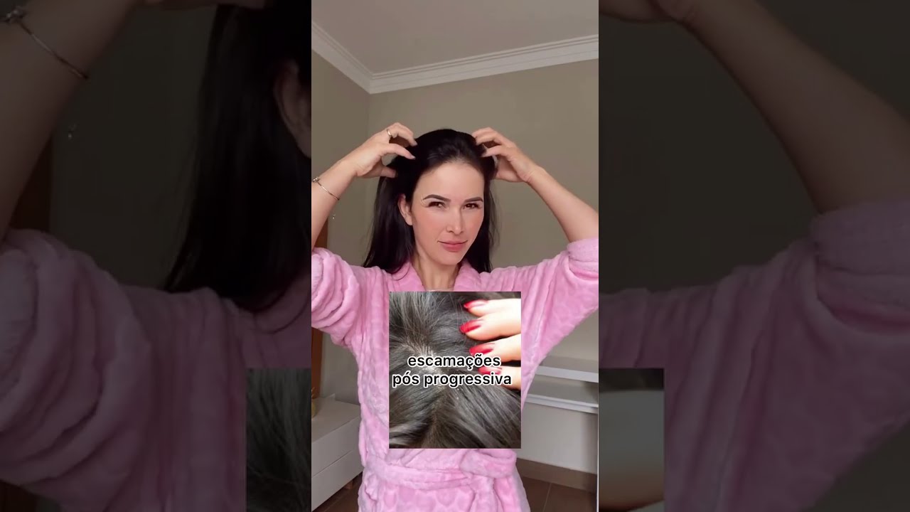 COMO TIRAR AS CASQUINHAS ou CASPA APÓS PROGRESSIVA!