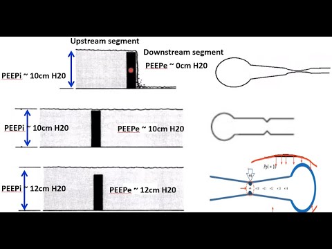 COPD Ventilation Physiology ~ Time Constant & Pride's Waterfall concept