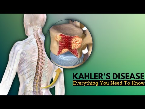 Pernicious Anemia Causes Signs and Symptoms Diagnosis and Treatment