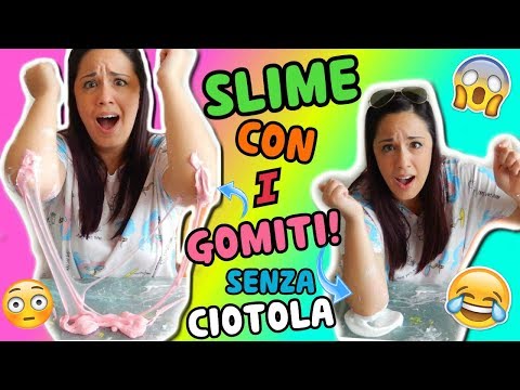 Che trattare capelli di psoriasi Eczema di dieta di dermatite