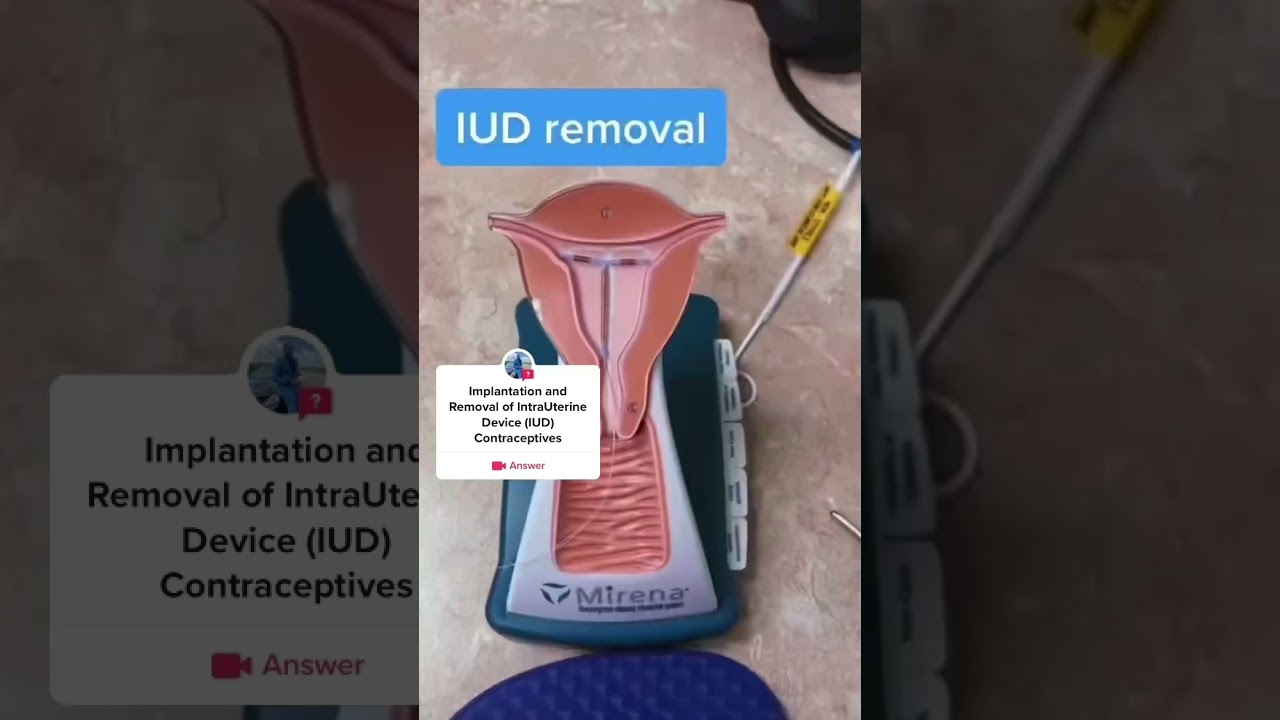 Intra Uterine Device (IUD) Implantation and Removal