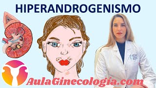 HIPERANDROGENISMO: SOP, ADRENAL, HIPERPLASIA SUPRARRENAL CONGÉNITA... - Ginecología y Obstetricia -