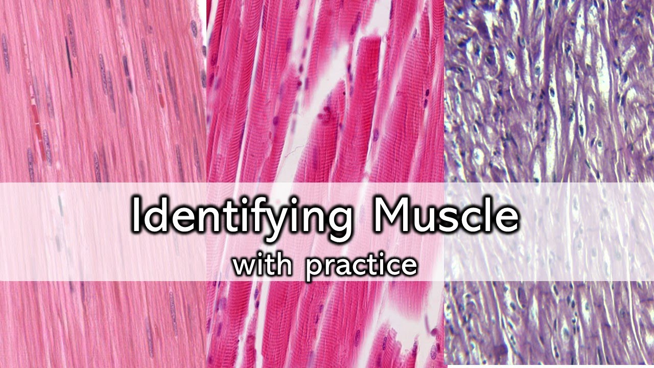 Identifying Muscle | Review and Practice