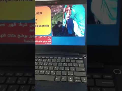 Part 1 Contagious agalactia in sheep and goat Prof Dr Hamed Attia