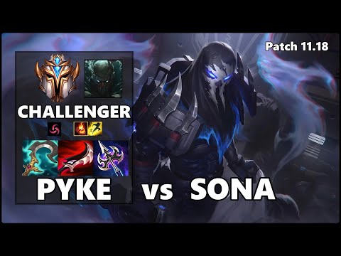 CHALLENGER Support Gameplay - PYKE vs SONA Patch 11.18