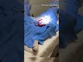 Vets Discover 3 FOOT WORMS In Dog During Surgery Charleston Southcarolina