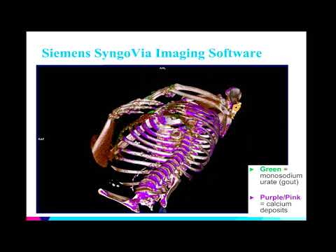 8th Annual TMII Symposium – 2018 – Session II – Cardiovascular Imaging – Sharon Barazani, BS