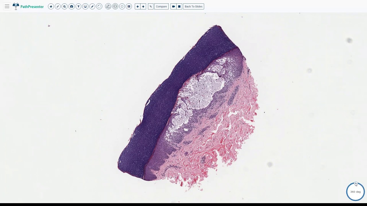 Lecture 1-Spongiotic Dermatitis