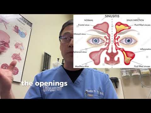 Will the Navage cure my sinus infections?