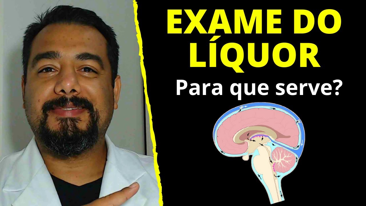Exame do Líquido Cefalorraquidiano (LCR): para que serve | Função | Líquor | Cerebroespinal