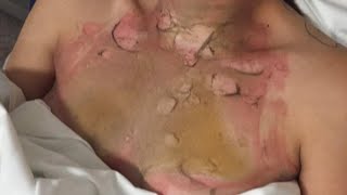 A Freak Accident Left Me Scarred!