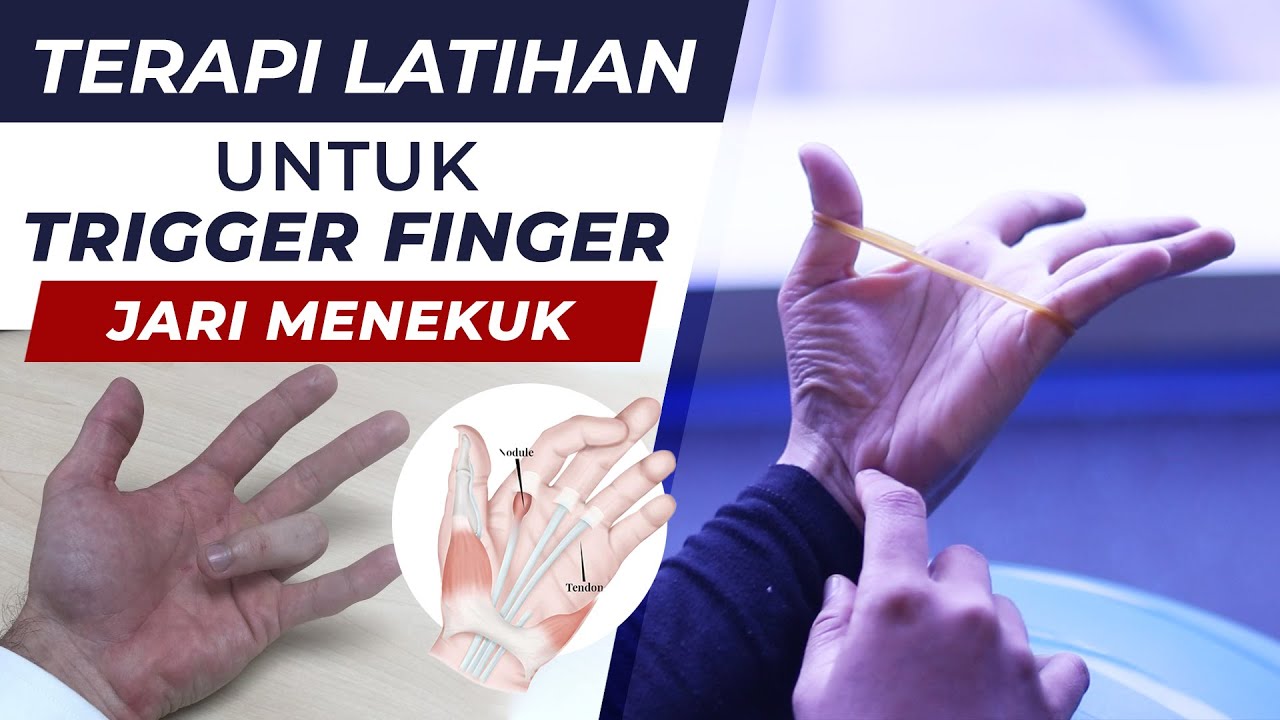 7 Terapi Latihan Untuk TRIGGER FINGER - Fisioterapi First Physio