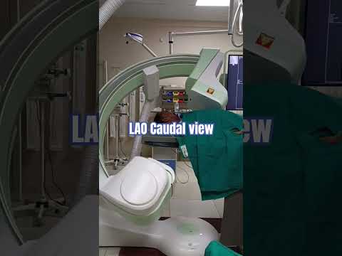 Cath lab machine views #cardiology #knowledge