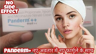 Panderm++ Cream Review in Hindi