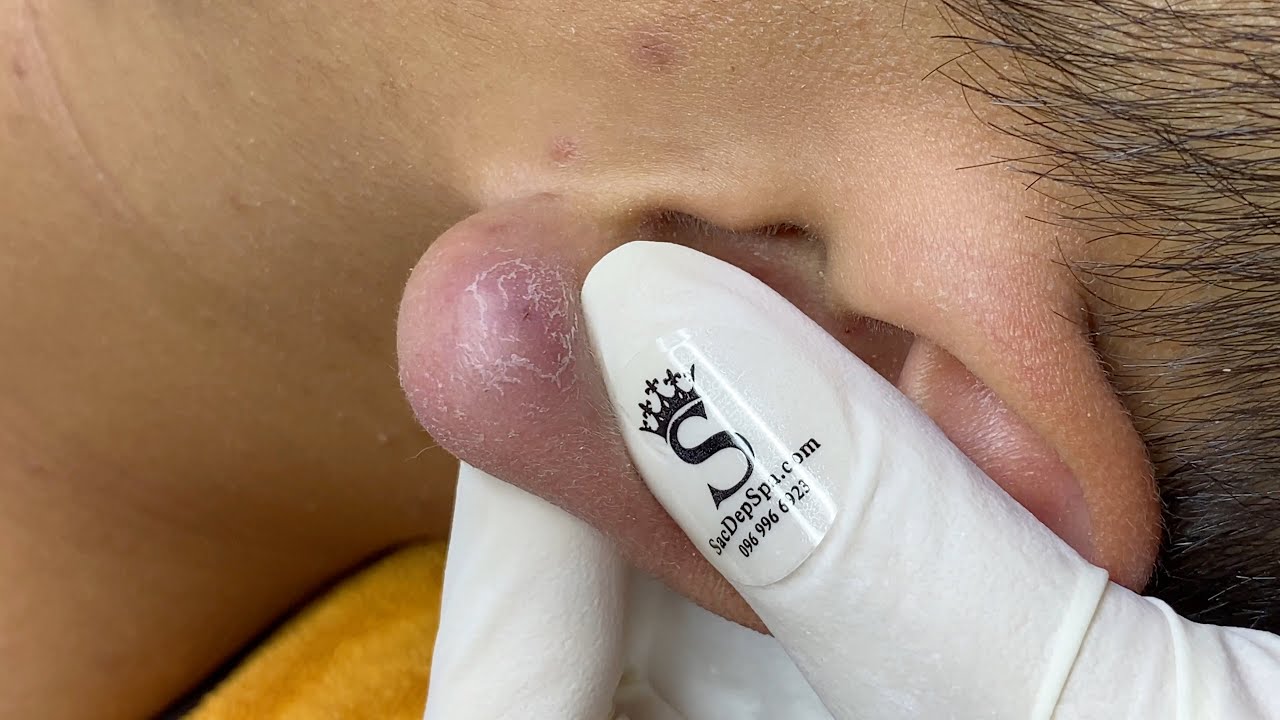 YouTube Thumbnail Downloader FULL HQ IMAGE