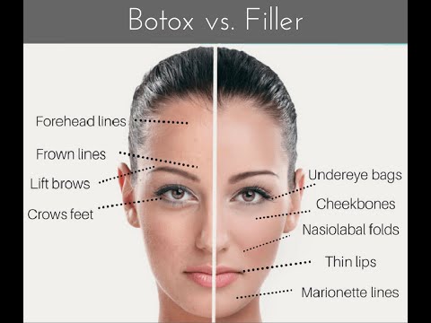 Botox VS Fillers