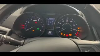 How to RESET/ REPROGRAM ANY HYUNDAI Veloster Computer -ECM, ECU, TCM, PCM