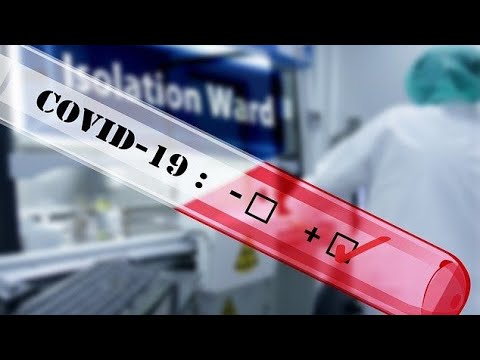 D-dimer test In COVID-19 patients