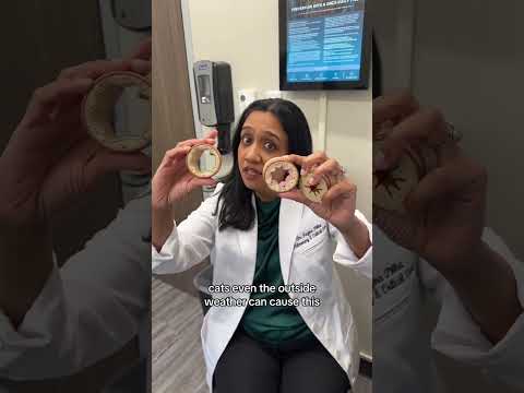 It’s not easy being wheezy 🫁 pulmonologist Dr. Pillai explains #asthma