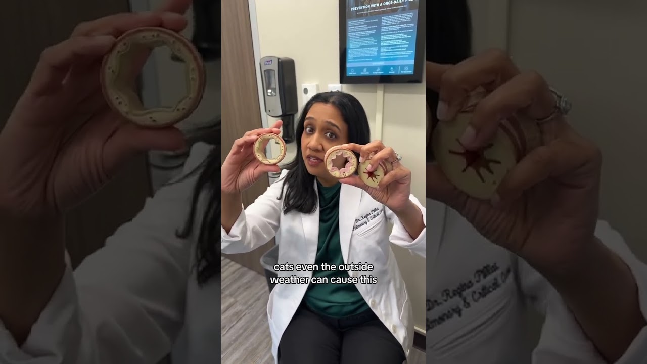 It’s not easy being wheezy 🫁 pulmonologist Dr. Pillai explains #asthma