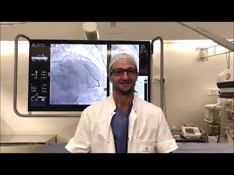 Résumé des études majeures publiées lors de l'ESC 2020