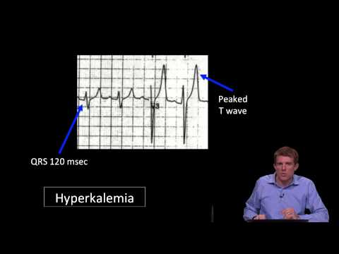 10j ECG Case1 Pt10 V1