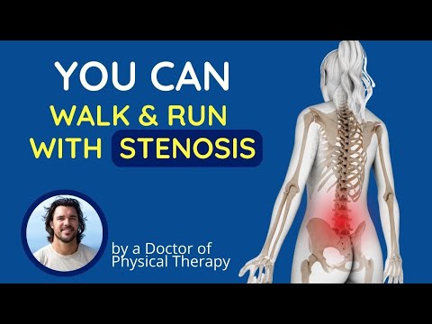 How to Walk and Run with Stenosis or Spondylolisthesis | Posture Correction