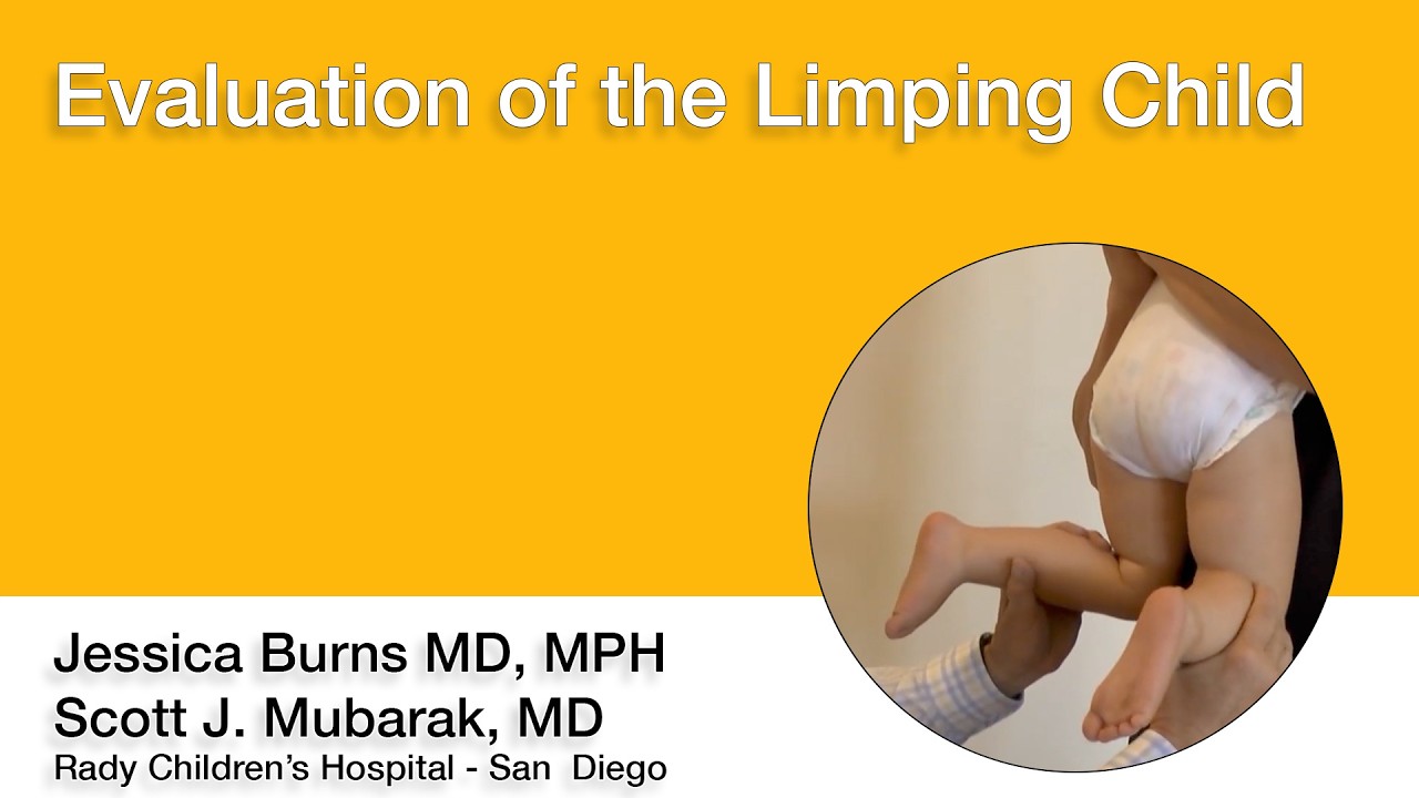 Evaluation of the Limping Child