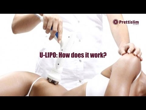U-Lipo @ Prettislim clinic. A smart way of  in India