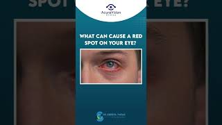 What can cause a red spot on your eye? | Dr. Shreya Nayak #shorts