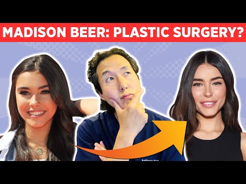 Madison Beerm Face Changes