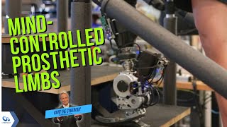 Breakthrough prosthetic technology enables natural movement through nervous system | CyberGuy