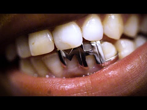 Grills- Jewellery for Your Teeth