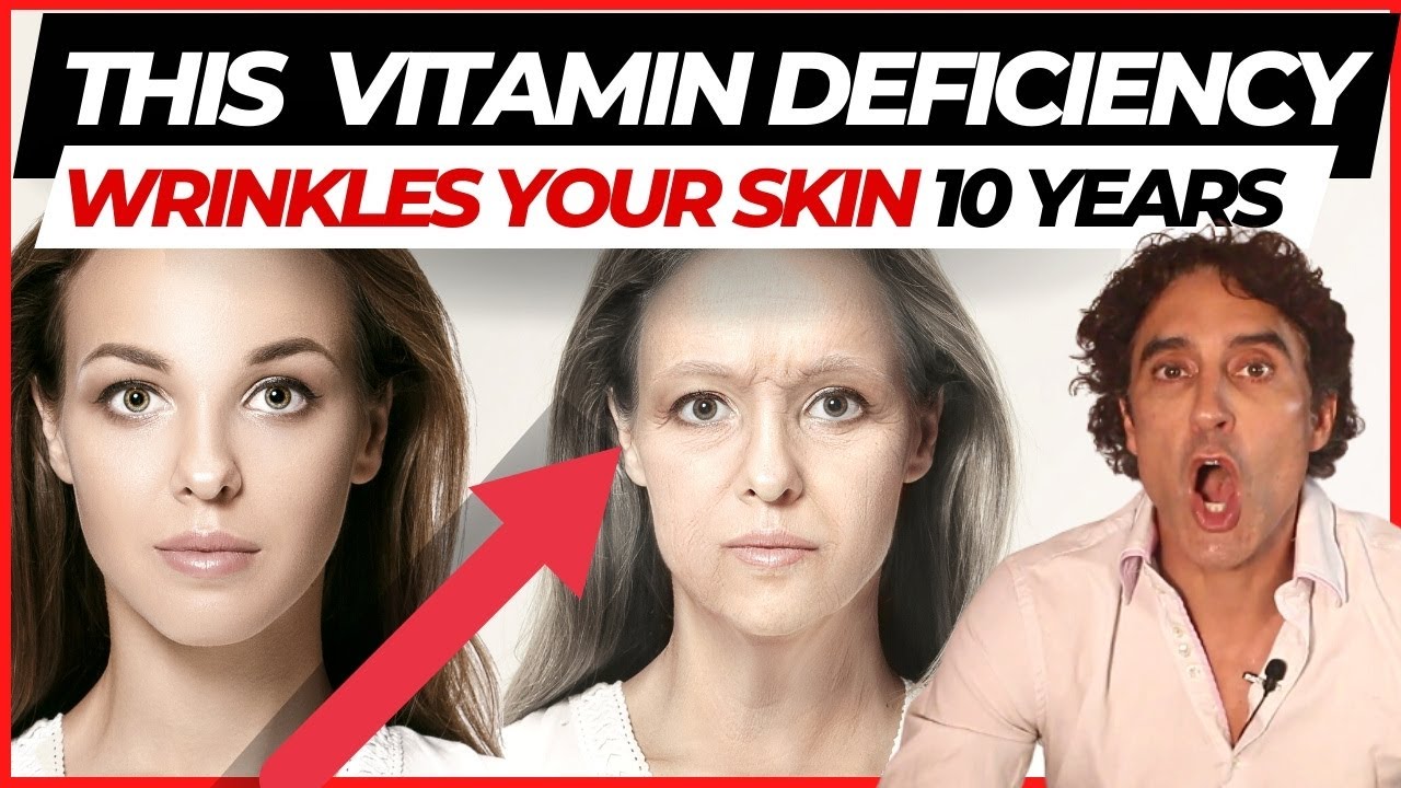🥗 THIS ONE VITAMIN DEFICIENCY WRINKLING YOUR FACE 🥗 // Vitamins For Skin Update