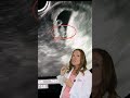 Can You HEAR The Heartbeat On A 7 Week Ultrasound