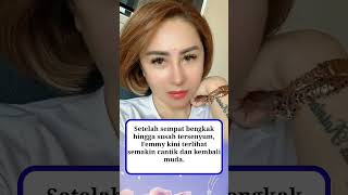 Download lagu Makin Cantik dan Terlihat Muda Usai Oplas, Femmy Permatasari Pamer Body Goals di Usia 49 Tahun mp3 Download lagu Makin Cantik dan Terlihat Muda Usai Oplas, Femmy Permatasari Pamer Body Goals di Usia 49 Tahun mp3