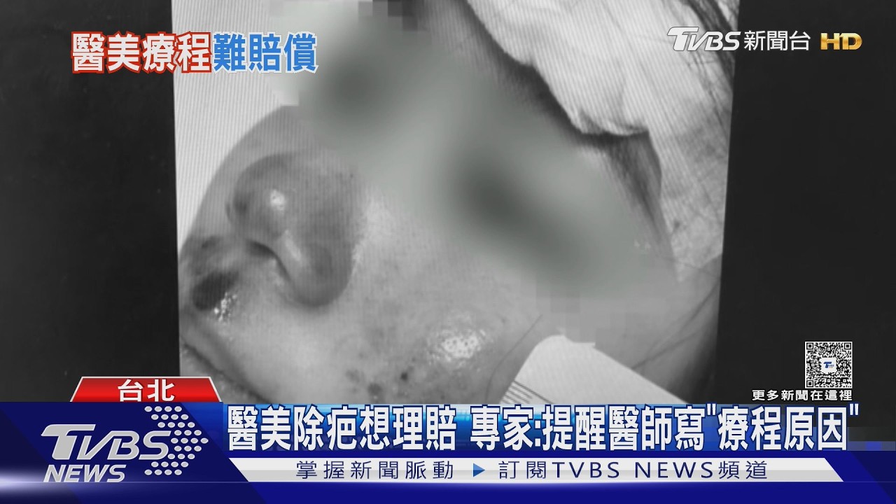 車禍留疤做醫美被拒賠!她氣炸控保險員「本來說有收據就理賠」