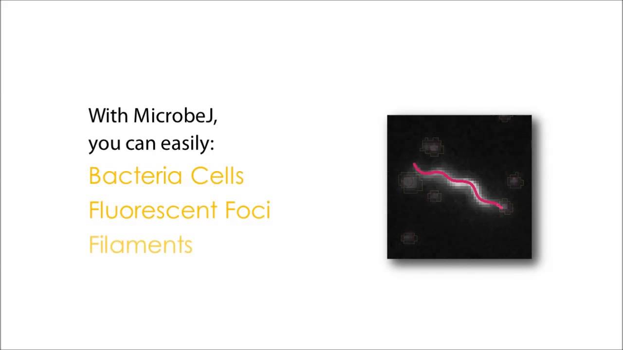MicrobeJ Presentation