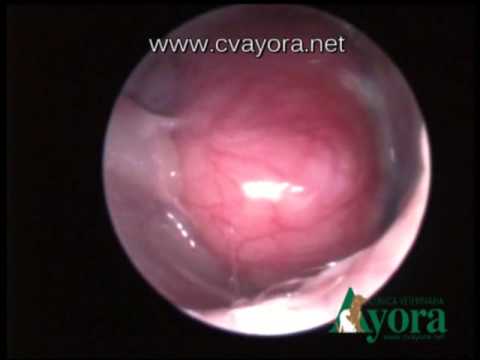 Simptome cancer esofag