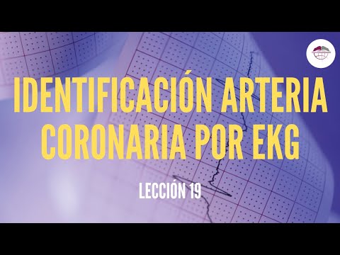 download video viral Cara Septal En Ekg, download Cara Septal En Ekg gratis, unduh video Cara Septal En Ekg